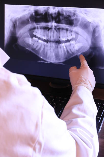 Best Emergency Root Canal Treatment in Howard City, MI