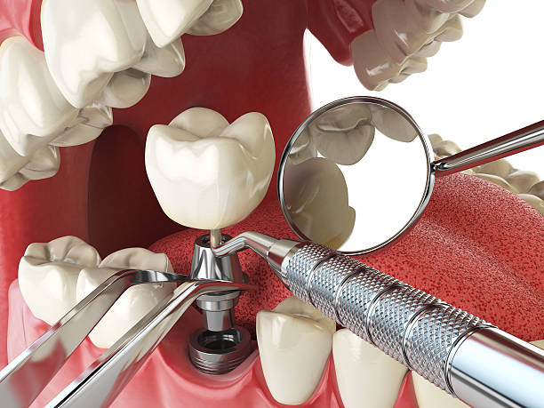 Best Orthodontic Emergency Dentist in Howard City, MI